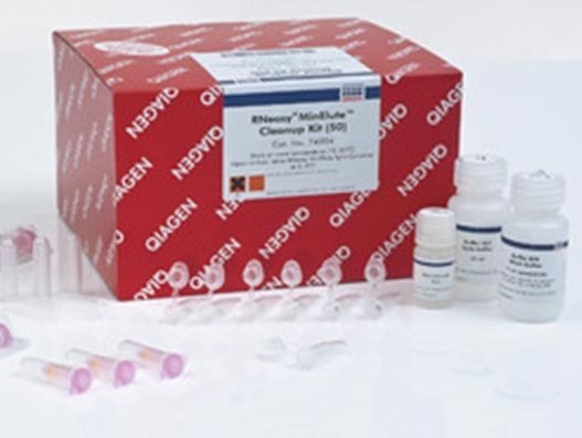 UPS speeds up global deliveries of QIAGEN Covid-19 test kits